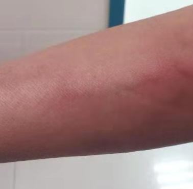 一般液体输多快,液体输快了好还是慢点好