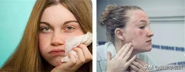 冬天脸干,连皱纹都出来了?日本女博士教你一招,抹几下白白嫩嫩