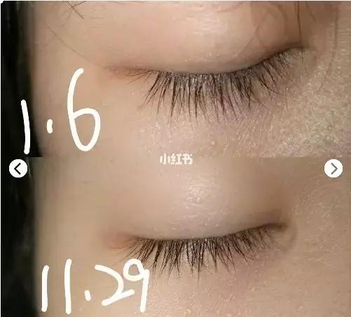 怎么挑选一款适合的眼霜,怎么选择一款适合自己的眼霜