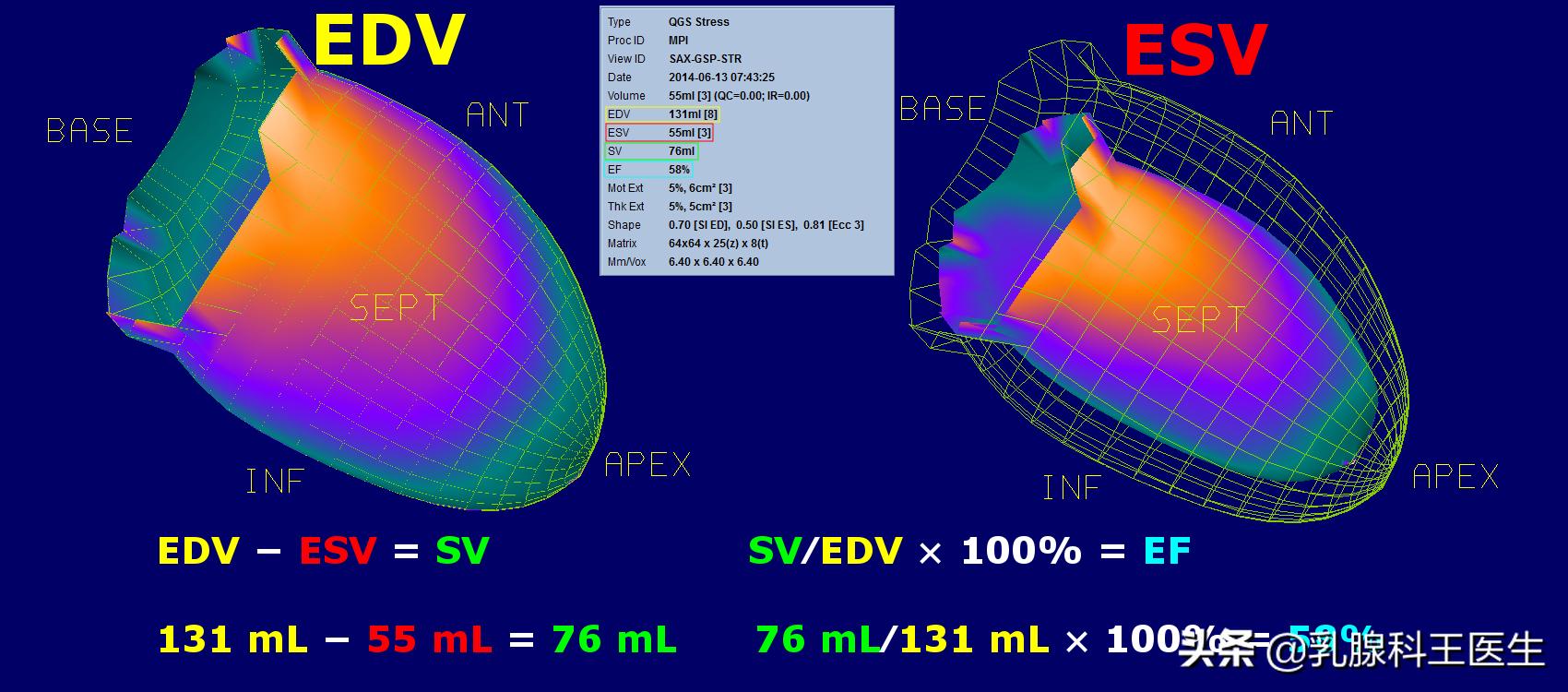 乳腺癌靶向治疗是不是心肌酶高,乳腺癌靶向药心脏毒性