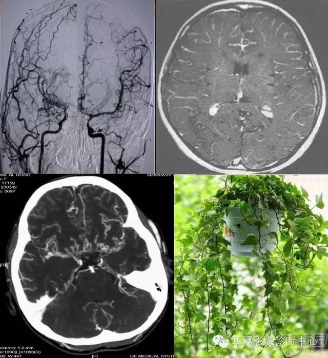 神经系统解剖及定位诊断视频,神经系统影像解析