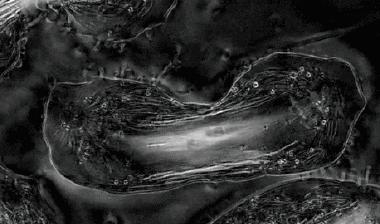 她拥有永生,靠此造福10亿人,死于癌症后,她的细胞带她重生!