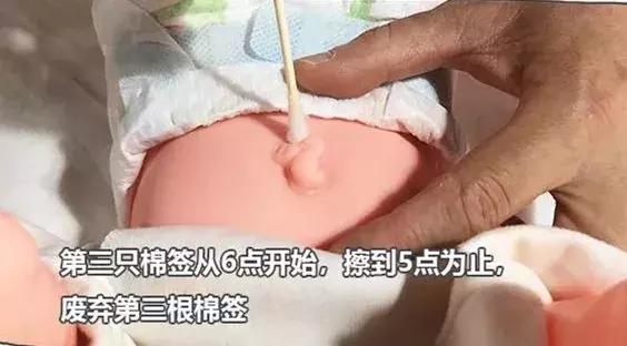 新生儿脐带一个月还没脱落正常吗,新生儿脐带一个月还没掉正常吗