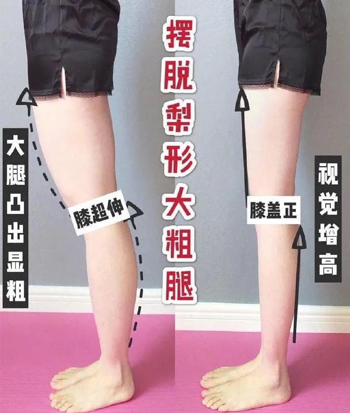 顽固性粗腿怎么瘦成筷子腿,腿型正常的小粗腿