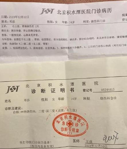 邓莎被烧伤原因,邓莎拔火罐被烧伤视频