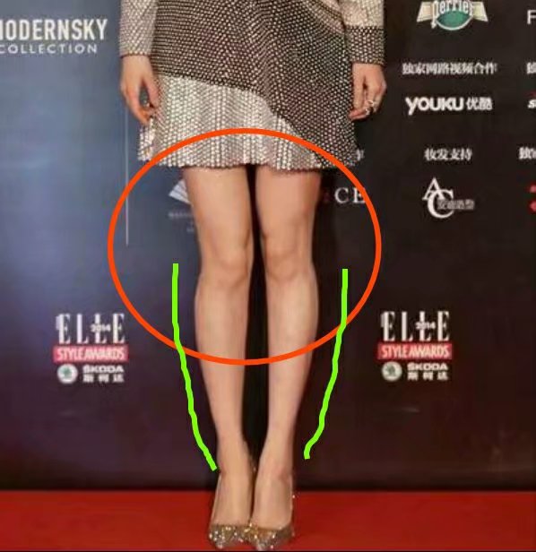 扁平足穿没有足底支撑的鞋,如何改善扁平足穿鞋的效果