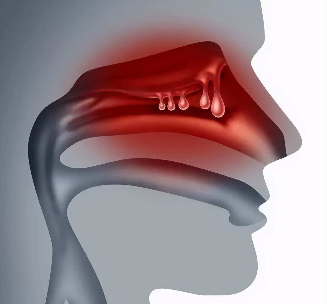老鼻炎怎么治,老人长期鼻炎需要注意什么