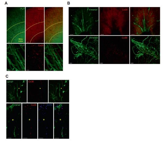 深部脑刺激法治疗癫痫,深部脑刺激术治疗焦虑