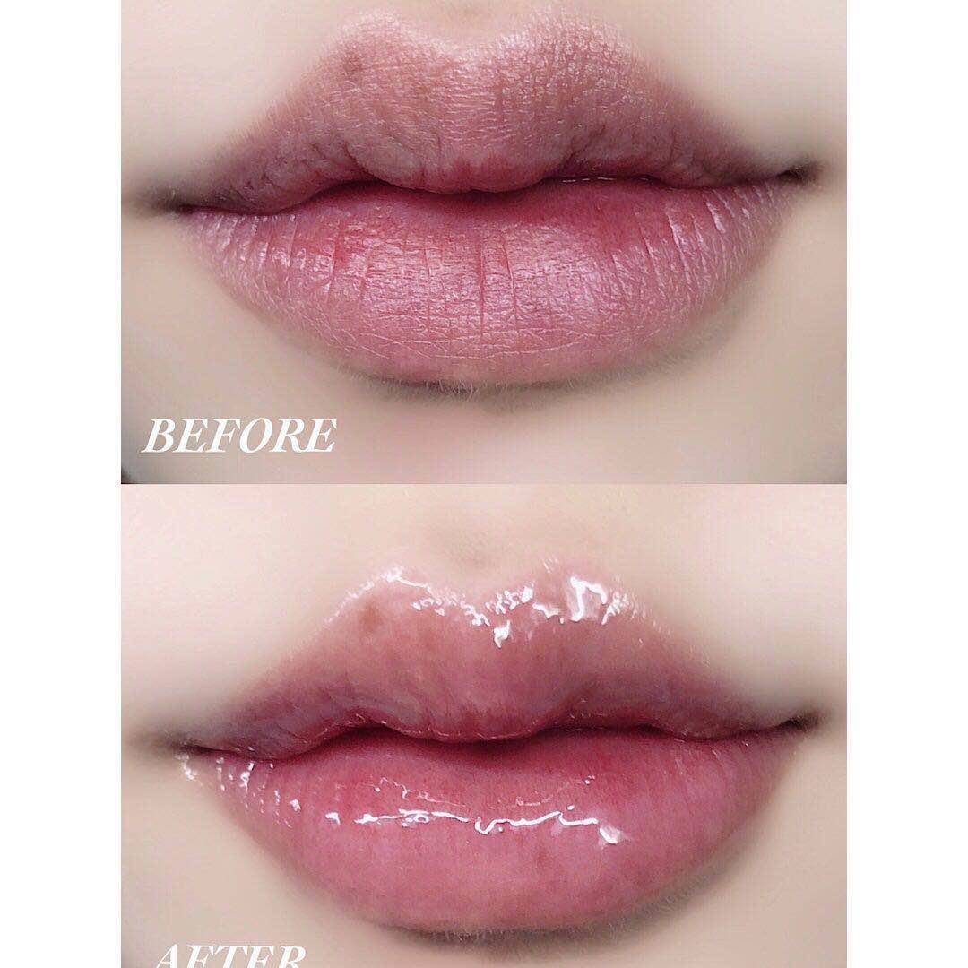 15岁女生必知5个护肤神器,秋冬必备面部护理