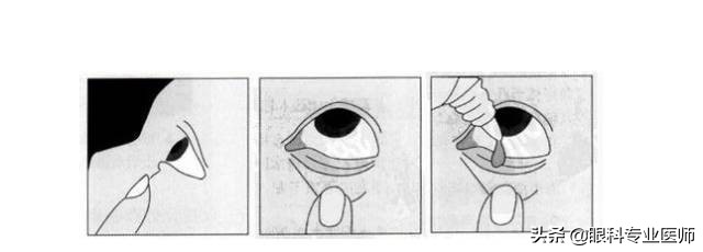 爱马仕眼药水可以天天用吗,眼药水里的爱马仕