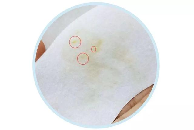 喷雾式的去黑头的东西,去黑头收缩毛孔吸黑头神器测评