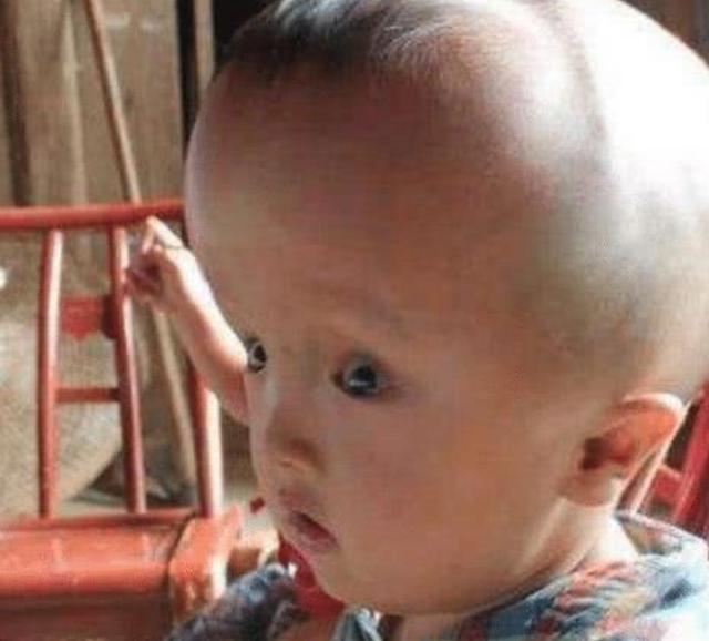 17年前喝“空壳奶粉”的大头娃娃，现在怎么样了？网友：不可原谅