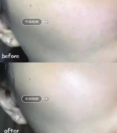 年轻人的抗老精华,用了惊艳的抗老精华