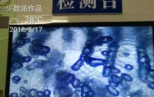 南美白对虾水霉病的处理方案,白对虾气泡病怎么防治