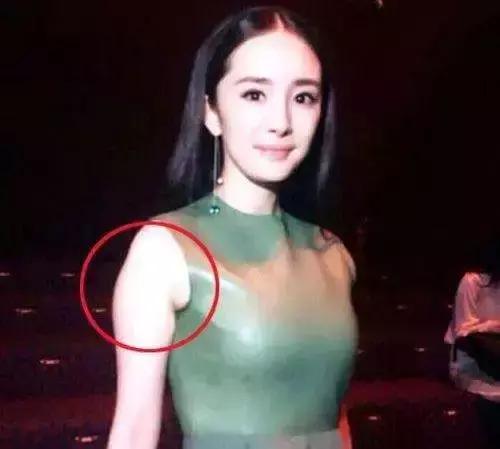 超模消除副乳,超模收副乳