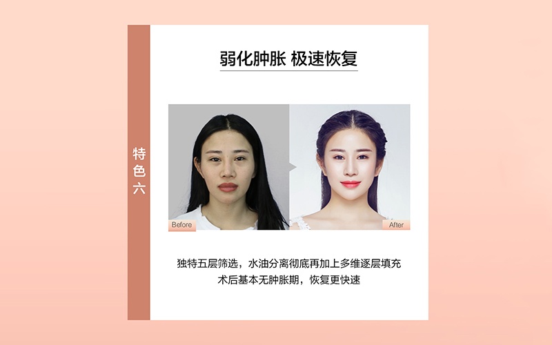 上海艺星整形图片,艺星整形芳华