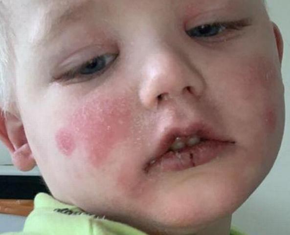 高烧引起的死亡病例,高烧致死的儿童