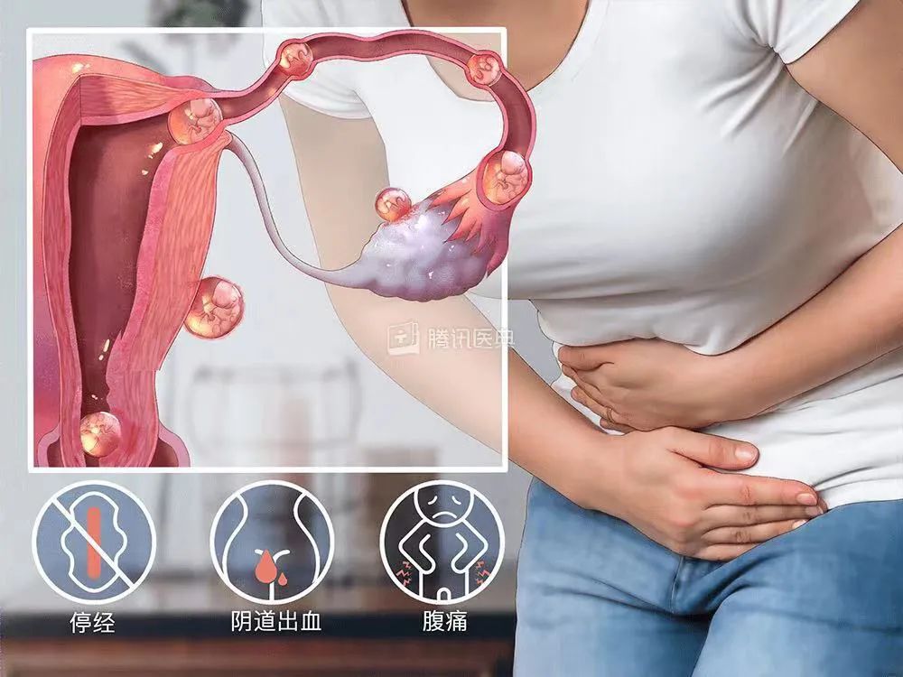 宫外孕微创手术的伤疤要涂什么药,宫外孕手术会不会留下伤疤