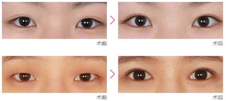 get美妆小技巧,教你打造气质深邃大眼妆