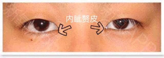 名门泽佳的正确涂法,名门泽佳祛皱小细节