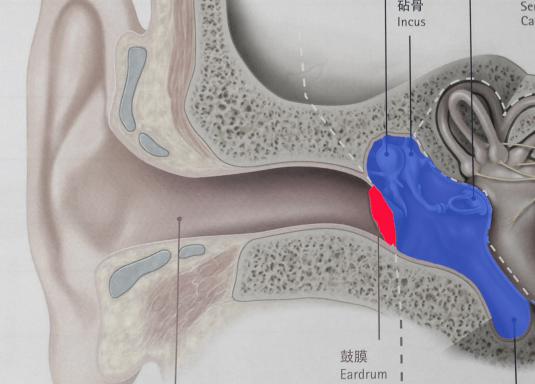 耳鼓膜修补手术方法有几种,爱耳日科普文章