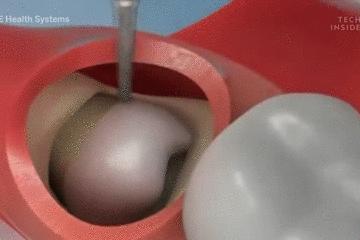 医生手术后最想做什么,医生做完手术以后会怎样