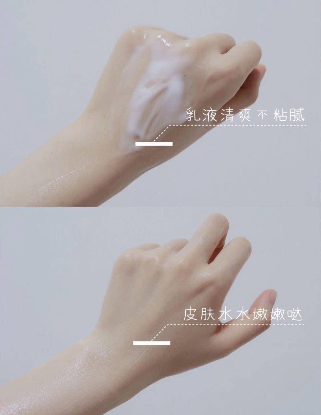 抬头纹和眼袋可以通过医美去掉吗,抬头纹很深医美上一般用什么填充