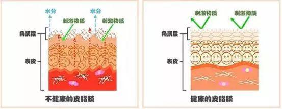如何有效修复敏感肌,适合油性敏感肌的精华