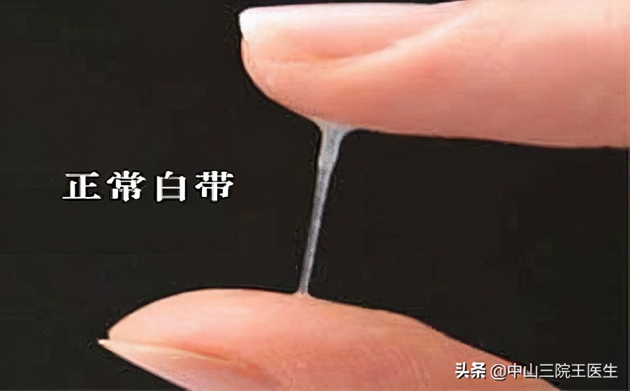 白带健康的晴雨表是什么意思,白带的晴雨表
