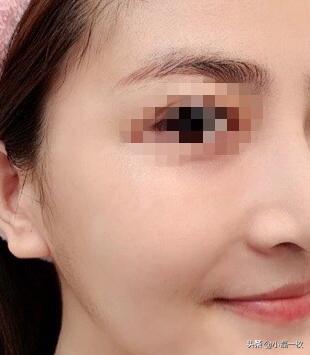 做医美真的可以变美,做什么医美可以让皮肤透亮