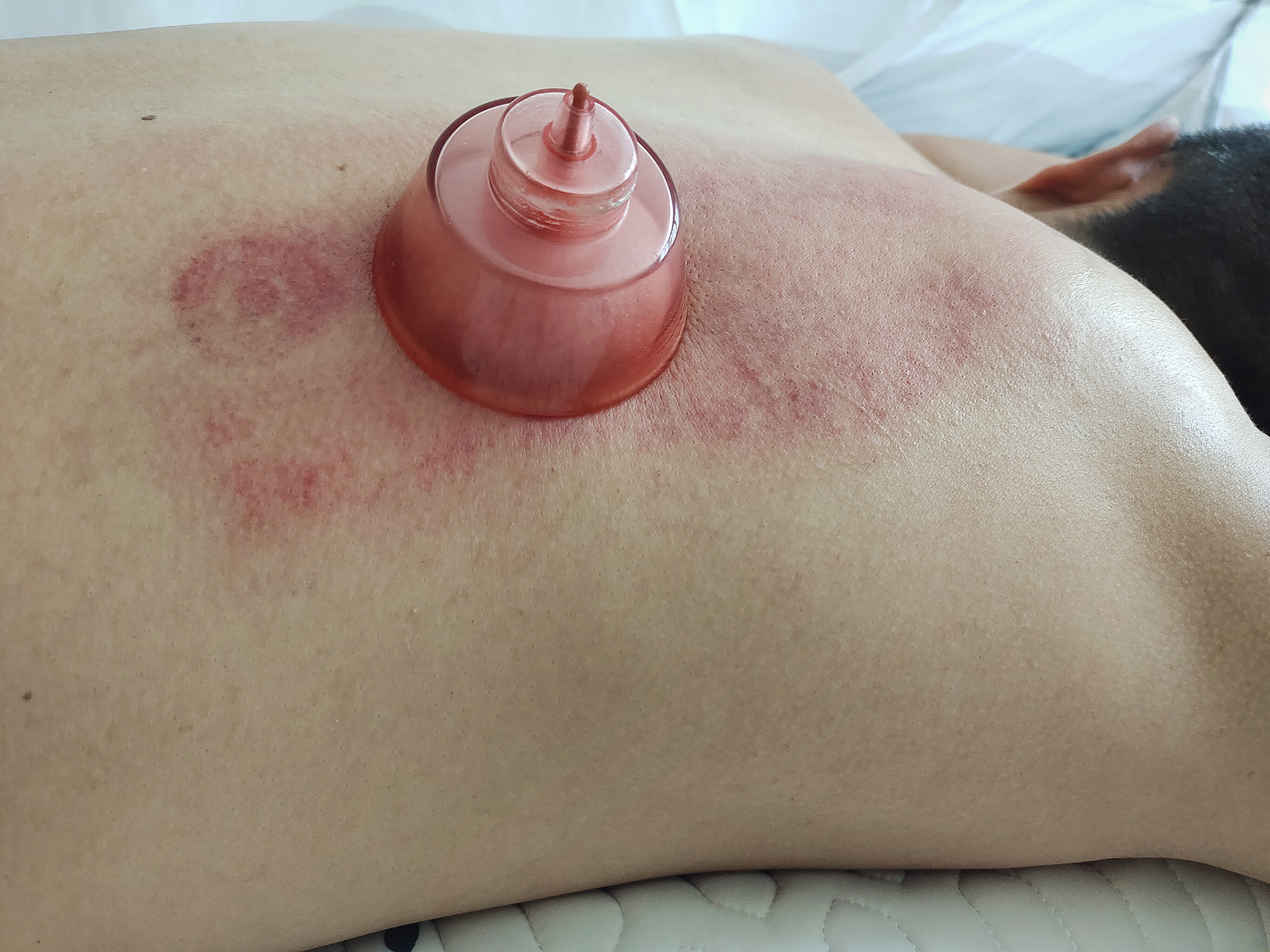 左点智能走罐刮痧器操作视频,电动走罐刮痧仪器的使用方法