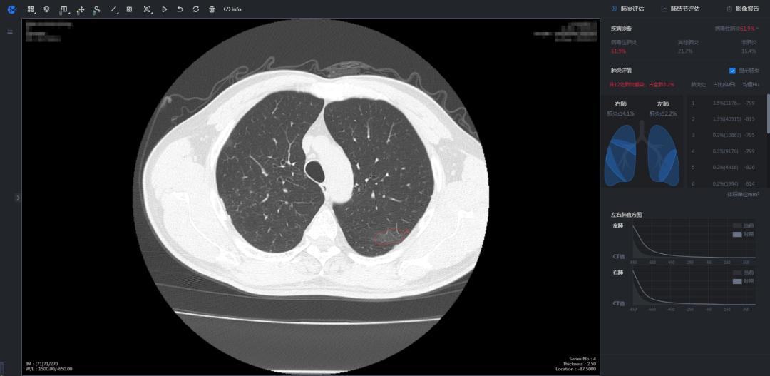 一个只烧钱不赚钱的行业，因为疫情迎来了春天