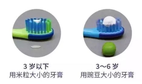 三岁孩子做根管治疗不配合,三岁小孩可以做根管治疗吗