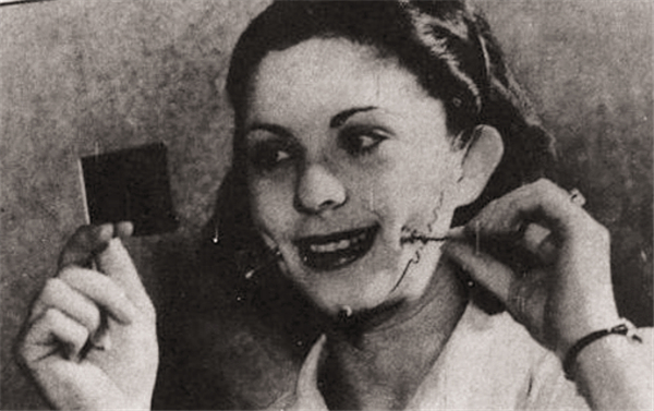 人造酒窝有什么坏处,人造酒窝真的靠谱吗