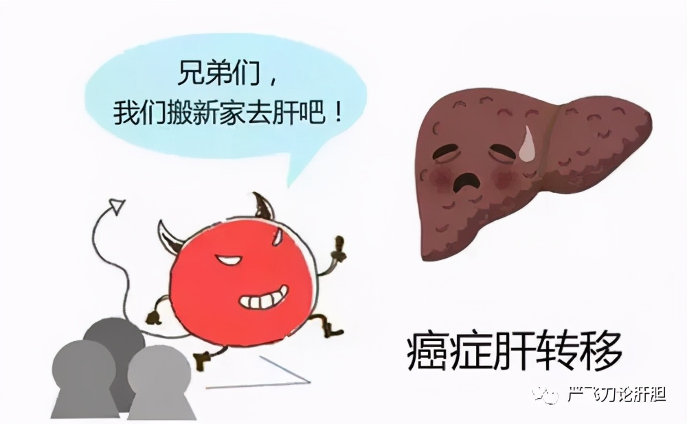 结肠癌肝转移痊愈案例,结肠癌肝转移治疗进展