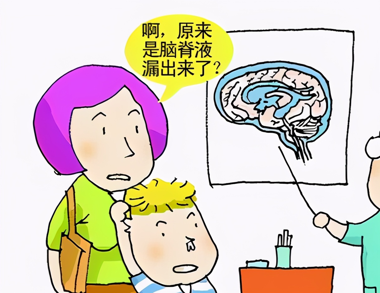 打喷嚏流鼻涕是脑脊液鼻漏吗,如何判断脑脊液鼻漏还是感冒