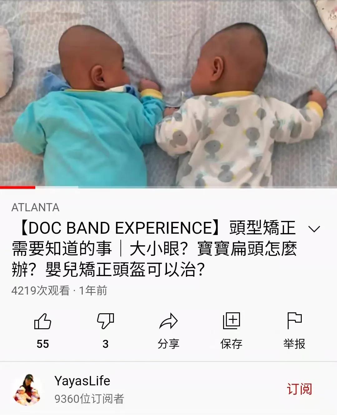 婴儿戴头盔矫正头型变畸形,婴儿戴摩托头盔