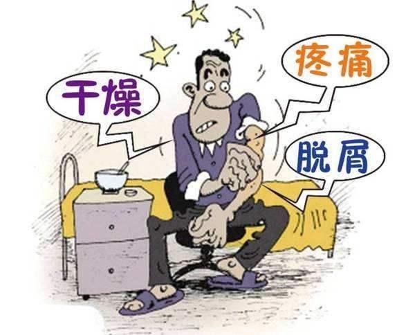 银屑病皮肤科医生肉眼就能确诊么,银屑病是皮肤病最严重的吗