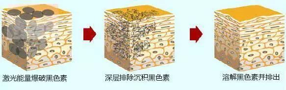 清洗纹身一般要几次,清洗纹身后需要注意什么