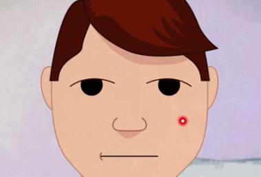 小孩伤口怎么不留疤,伤口怎么不留疤快速恢复