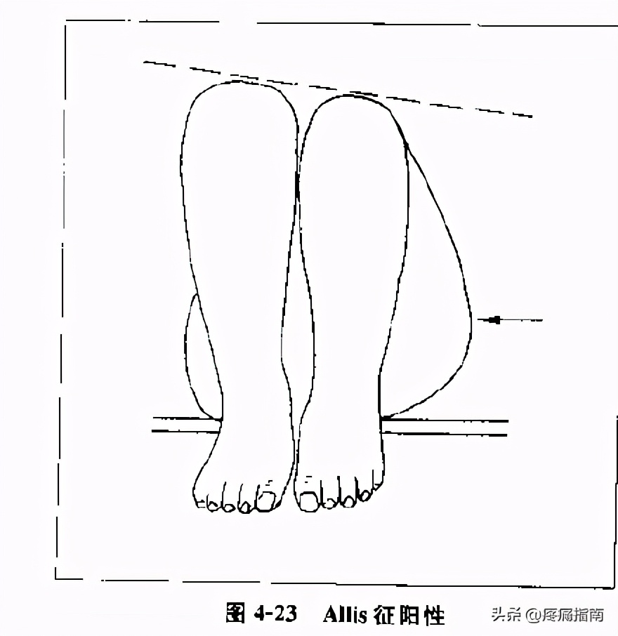 夏天无注射液能治疗骨头坏死吗,骨头坏死用针刀镜有用么