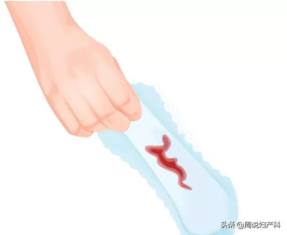 经量过多而且经期长用什么药,月经出血量大是子宫内膜癌不