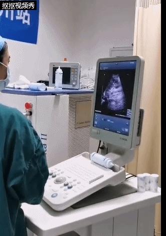 小儿尿道结石如何碎石,小儿尿结石