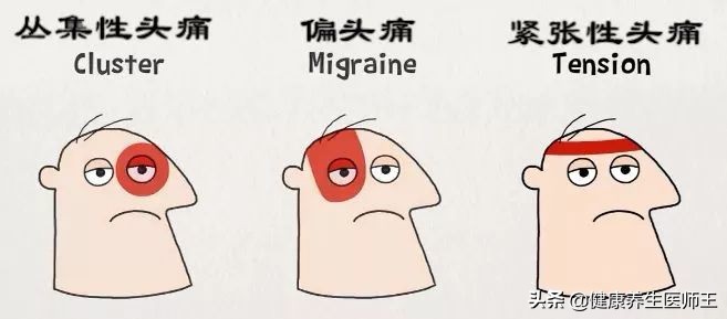 人体健康之丛集性头痛