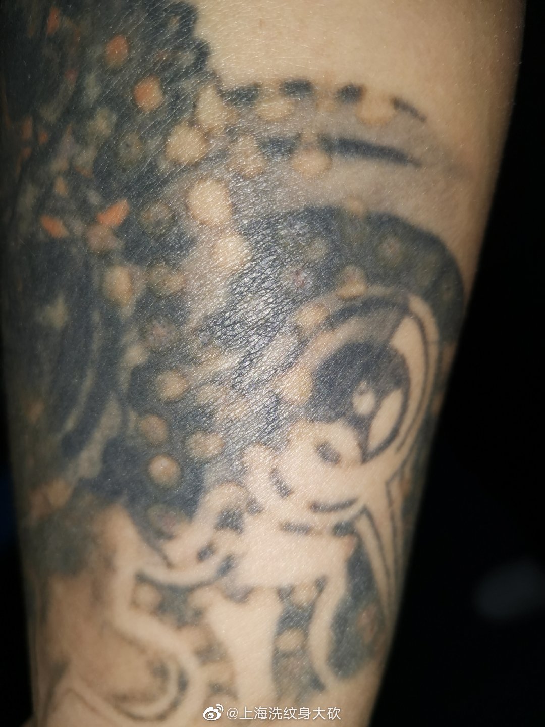 看完洗纹身的全过程,纹身的有效洗纹身方法