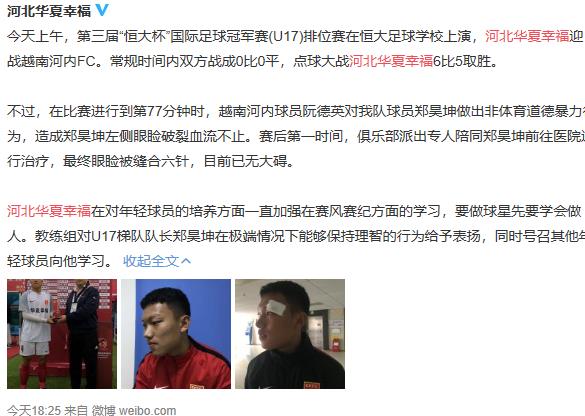 足球场上令人气愤的瞬间,足球比赛各种扎心场面