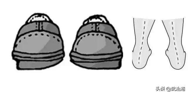 总是磨鞋底怎么办,总是磨鞋底是什么原因