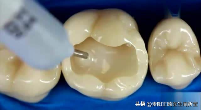 各类口腔治疗后的注意事项,口腔养护的基本方法和操作