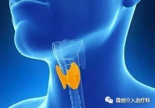 哈尔滨微创消融甲状腺结节哪家好,甲状腺结节微创消融术的过程