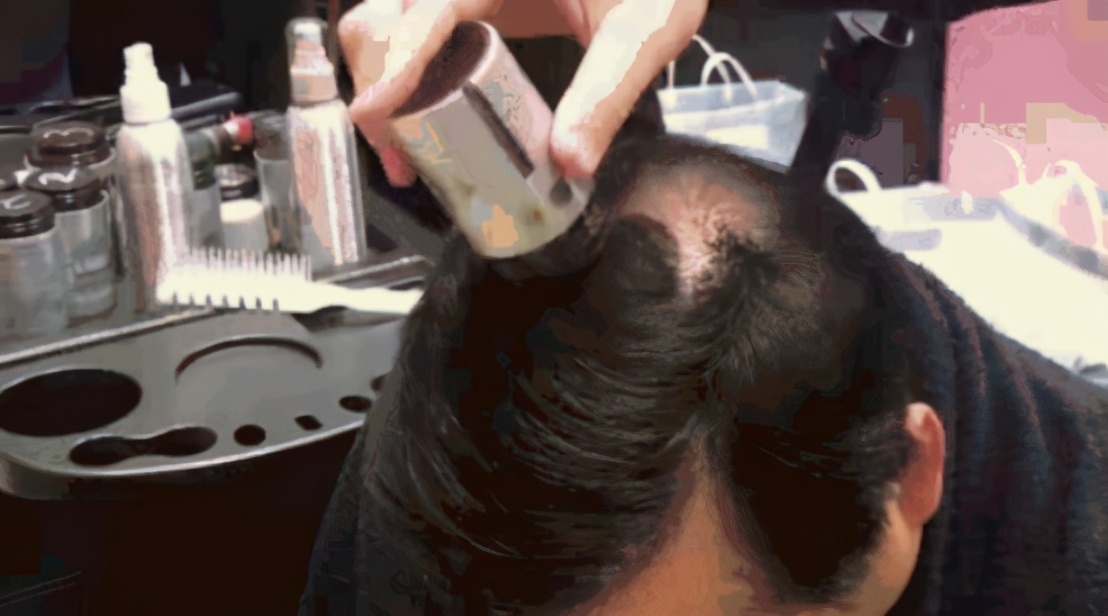 日本人秃头,日本秃头率亚洲第一